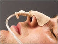 EA/1 DALE NASOGASTRIC TUBE HOLDER, ONE SIZE FITS MOST