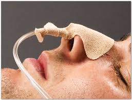 EA/1 DALE NASOGASTRIC TUBE HOLDER, ONE SIZE FITS MOST